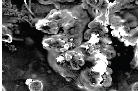 Scanning electron microscope (SEM) picture of pavalasilasathu parpam
