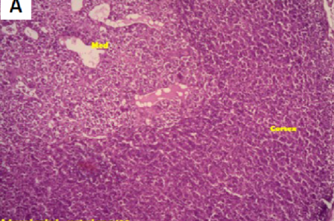 Histology of adrenal gland after 7 days treatment with aqueous extract of Antidesma menasu leaves in rats