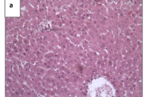 Histological figues of liver sections of rats teated with